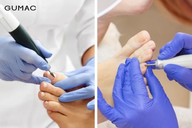 Mài nhẵn đầu móng