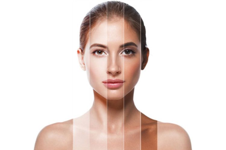 đặc điểm màu da vàng